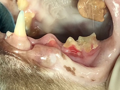 Unterkiefer links mit klinisch auffälligen Kronen und deutlichen Entzündungszeichen am Übergang von den Kronen zum Zahnfleisch, mit Zahnstein und Zahnbelag