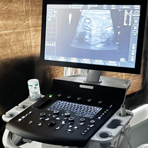 digitales ultraschallgeraet versana scilvet/ge