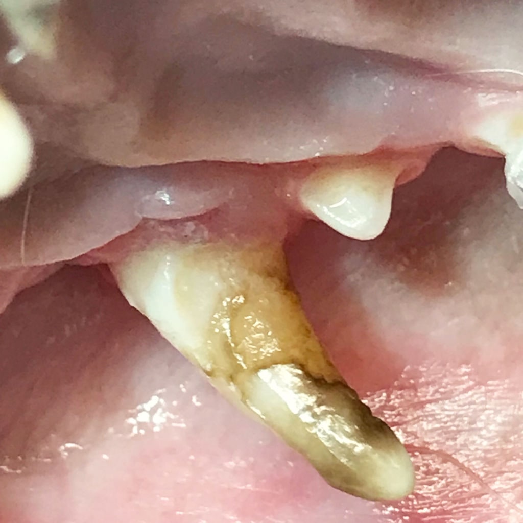 Entfernung des geschädigten Zahnsubstanz und Abschrägung des Schmelzrandes zur Oberflächen-vergrößerung