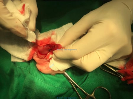 Operation einer Katze Entfernung eines Wurstklipps aus dem Darm Teil 1